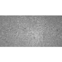 Skin Rejuvenating Effect of Consciousness Energy Healing Treatment Based Herbomineral Formulation