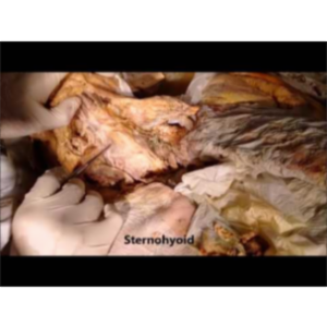 Topographical Neck Dissection-Triangles and Muscles - Dr Sanjoy Sanyal icon