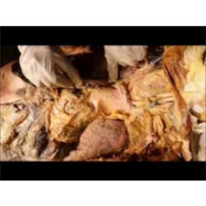 Mediastinum to Neck-Scalene Triangle-Thyroid Gland - Sanjoy Sanyal icon