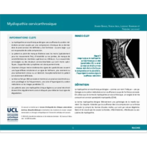 Myélopathie cervicarthrosique