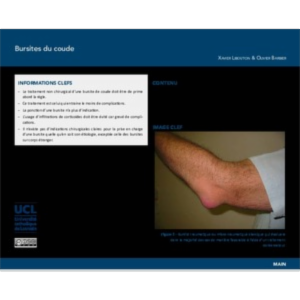 Bursites du coude icon