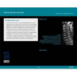 Hernie discale cervicale icon