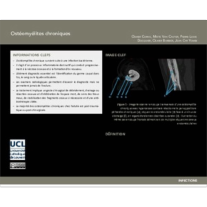 Ostéomyélites chroniques icon