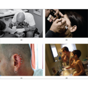 AP05 - Anatomy Physiology - The Integumentary System