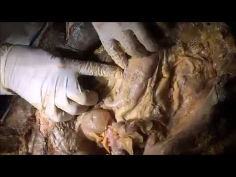 Colonic Landmarks-Abdominal Viscera Overview - Sanjoy Sanyal