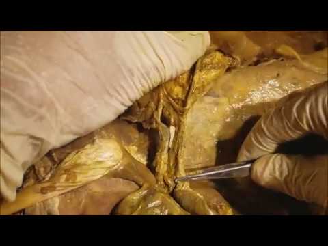 Celiac Trunk-Portal Vein-Bile Duct Surgical Dissection - Sanjoy Sanyal icon