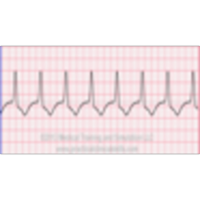 Arrhythmia Reference Guide icon