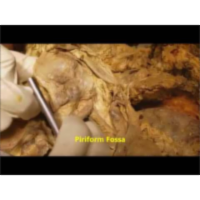 Interior of Larynx-Trachea-Laryngopharynx-Piriform Fossa and Thyroid Neurovascular - Sanjoy Sanyal