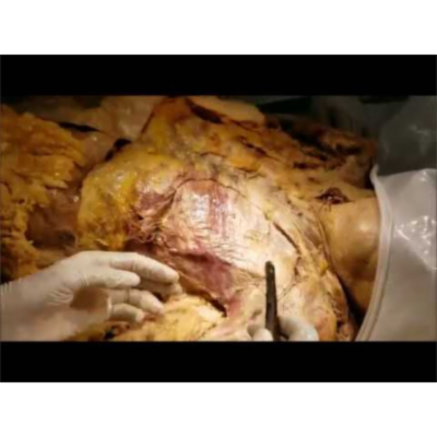 Anterior Pectoral Girdle Muscles Narrative Dissection-Sanjoy Sanyal icon