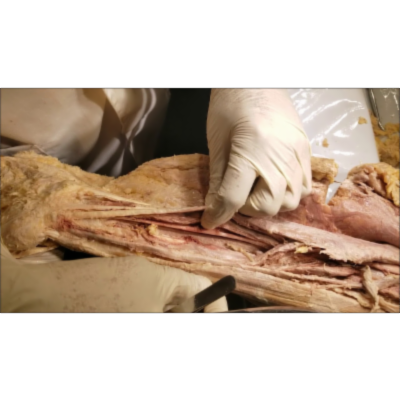 Forearm Flexor Muscles-Critical Wrist Structures Dissection - Sanjoy Sanyal icon