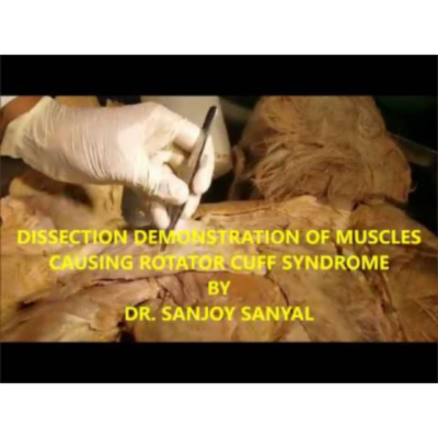 Dissection-Demonstration of Muscles Causing Rotator Cuff Syndrome - Sanjoy Sanyal icon