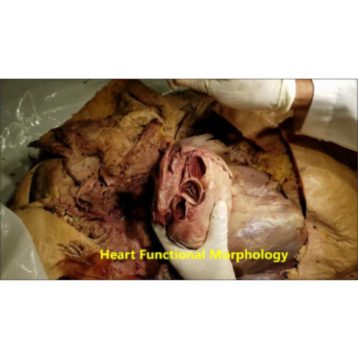 Functional Morphology of Human Heart-Clinical Aspects of Pericardium - Sanjoy Sanyal icon