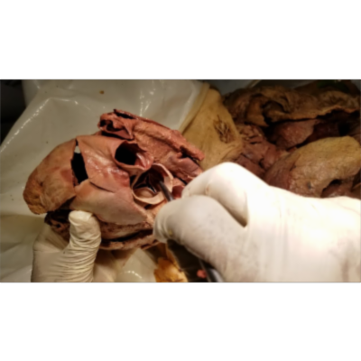 Open Heart Dissection and Narrative Description of its Inner Chambers - Sanjoy Sanyal