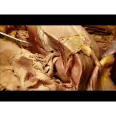 Celiac Trunk Branches - UNIQUE COMPOSITE Clinical Demonstration – Sanjoy Sanyal icon