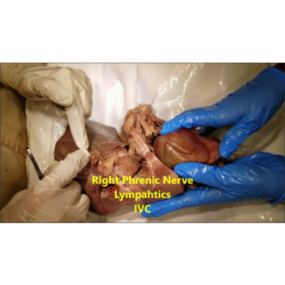 Eviscerated Liver – Topography Spaces Ligaments Fissures – Clinical Narration – Sanjoy Sanyal icon