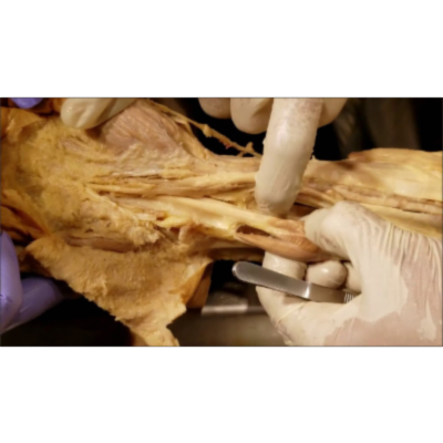 Hand and Wrist – Carpal Tunnel Anatomical Snuffbox and Extensor Retinaculum – Sanjoy Sanyal icon