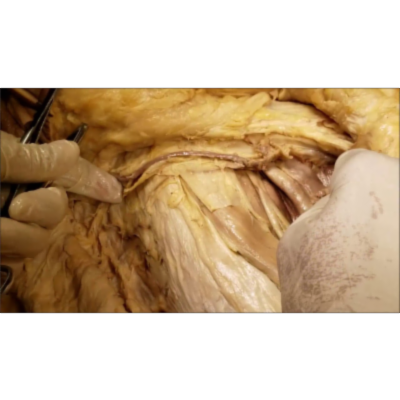 Femoral Triangle Adductor Canal Nerve-Vessels – Femoral Canal Hernia - Sanjoy Sanyal icon