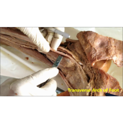 Anterior-Lateral Leg Compartments Muscles Nerves and Artery - Sanjoy Sanyal icon