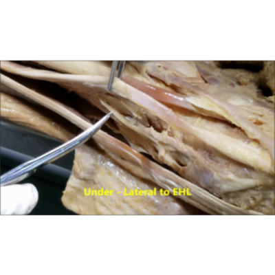 Anterior Leg - Foot Dorsum Muscles Nerve and Artery - Sanjoy Sanyal icon