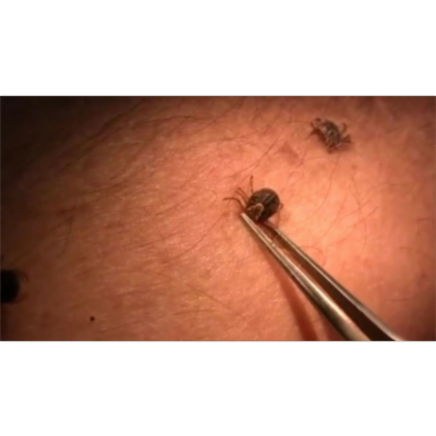 Enfermedad de Lyme - Qué es y cómo tratarlo |Enfermedad de Lyme icon