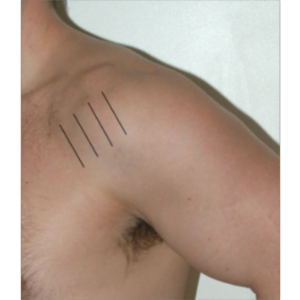 Ultrasound of the Shoulder icon