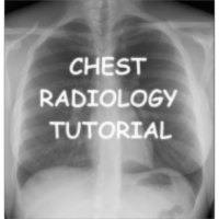 Chest Xray Tutorial icon