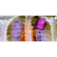 Clinical Care Options: Oncology Audio Podcast icon