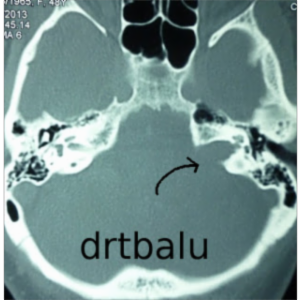 Tutorials in otolaryngology icon