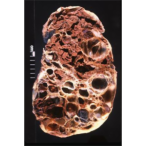 M2 Renal- Renal Pathology Overview Notes icon
