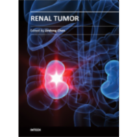 Renal Tumor icon