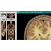 The NPAC Visible Human Viewer icon