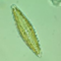 Diatom Specimens