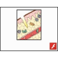 Nonspecific Inflammatory Response