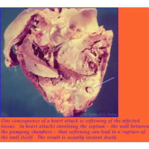 NOVA Online/Cut To The Heart icon