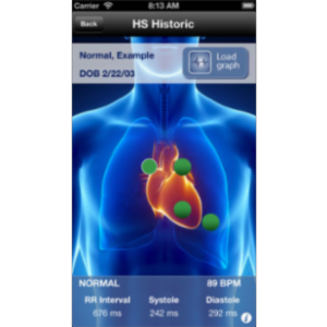 SensiCardiac App for iOS icon