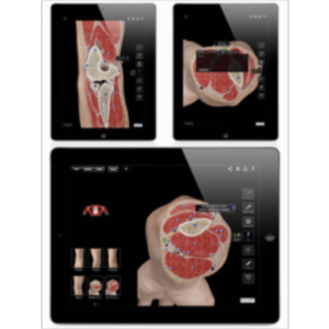 Elbow Pro III App for iPad