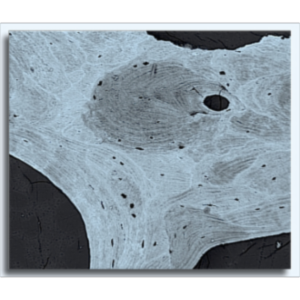 Osteoporosis and Bone Physiology icon