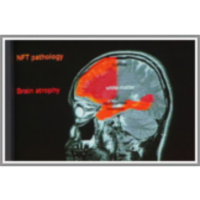 Change Your Mind: Memory and Disease icon